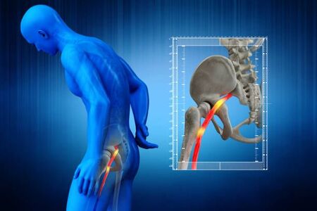 The Sciatic Nerve